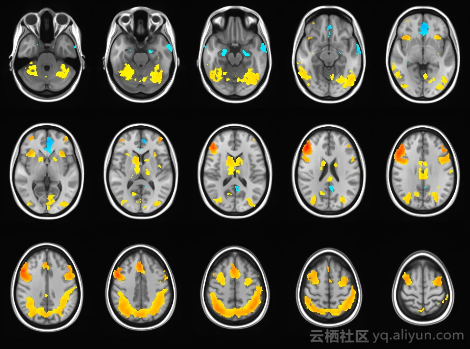 fmri