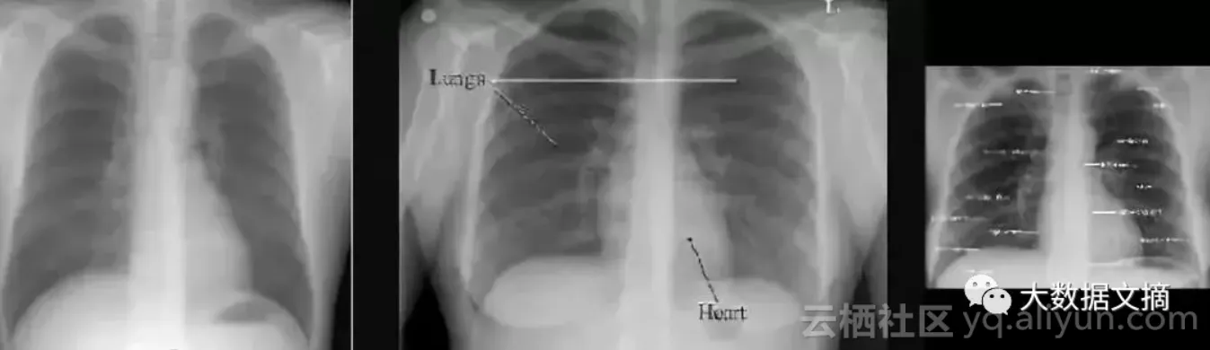 9052e76d4e92c26316147486062e4e59078fcde4